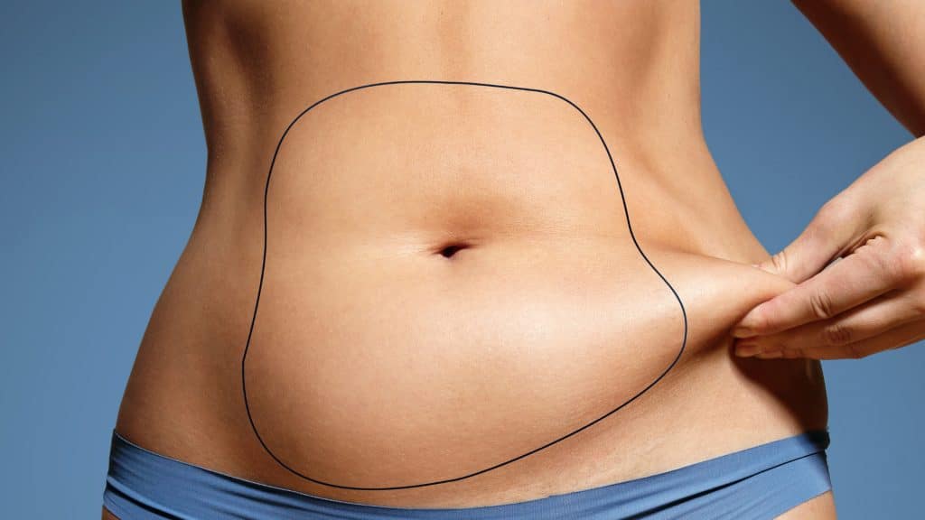 Weight loss after liposuction